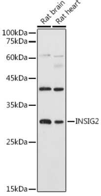 Western Blot: INSIG-2 AntibodyAzide and BSA Free [NBP3-03000]